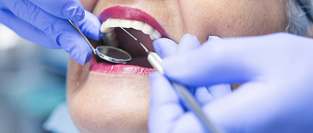 Best Emergency Dentist for Lost Fillings or Crowns in Pearson, GA